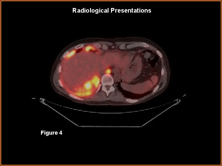 Radiological Presentations Figure 4 