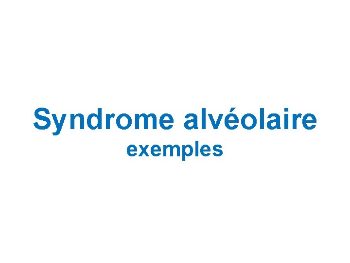 Syndrome alvéolaire exemples Syndrome alvéolaire exemples