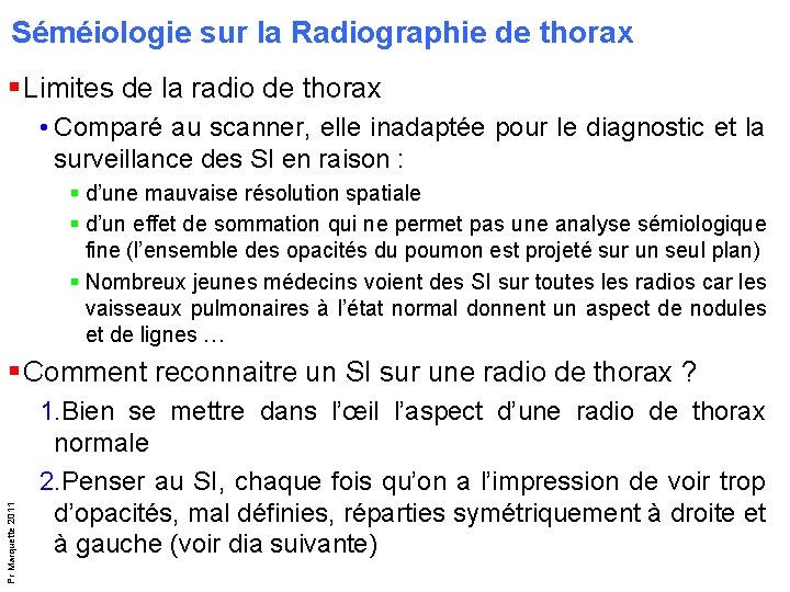 Séméiologie sur la Radiographie de thorax § Limites de la radio de thorax • Séméiologie sur la Radiographie de thorax § Limites de la radio de thorax •