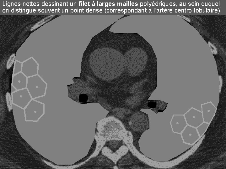 Lignes nettes dessinant un filet à larges mailles polyédriques, au sein duquel on distingue Lignes nettes dessinant un filet à larges mailles polyédriques, au sein duquel on distingue