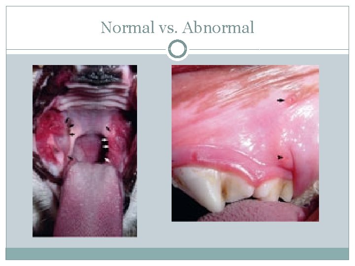 Normal vs. Abnormal 