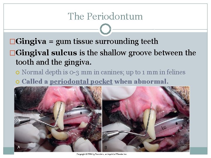 The Periodontum �Gingiva = gum tissue surrounding teeth �Gingival sulcus is the shallow groove