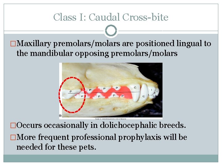 Class I: Caudal Cross-bite �Maxillary premolars/molars are positioned lingual to the mandibular opposing premolars/molars