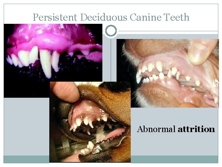 Persistent Deciduous Canine Teeth Abnormal attrition 