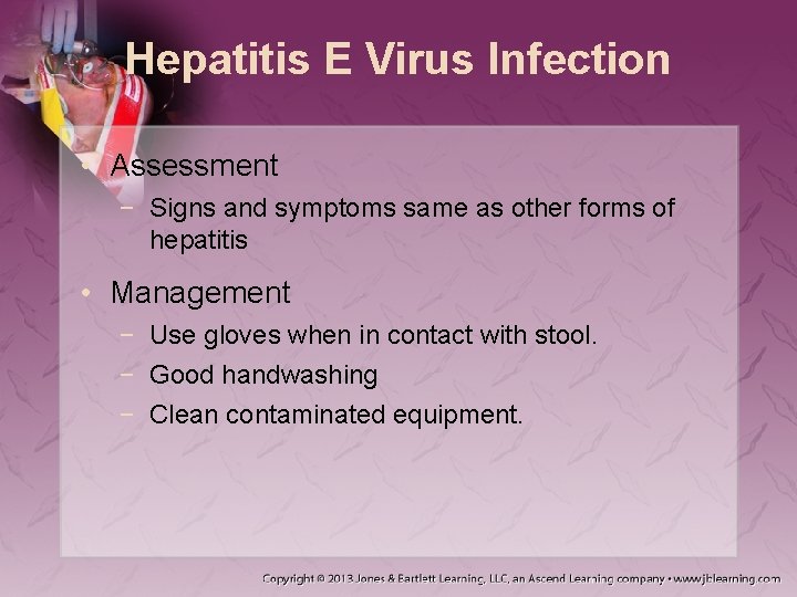 Hepatitis E Virus Infection • Assessment − Signs and symptoms same as other forms
