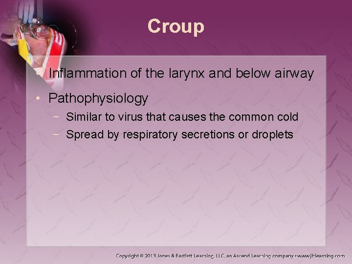 Croup • Inflammation of the larynx and below airway • Pathophysiology − Similar to