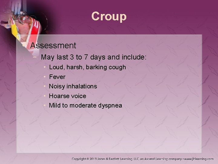 Croup • Assessment − May last 3 to 7 days and include: • •