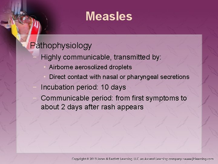 Measles • Pathophysiology − Highly communicable, transmitted by: • Airborne aerosolized droplets • Direct