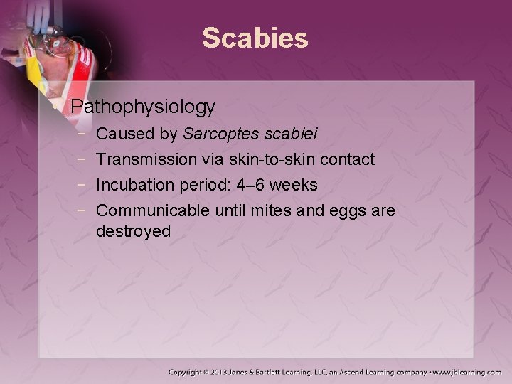 Scabies • Pathophysiology − − Caused by Sarcoptes scabiei Transmission via skin-to-skin contact Incubation