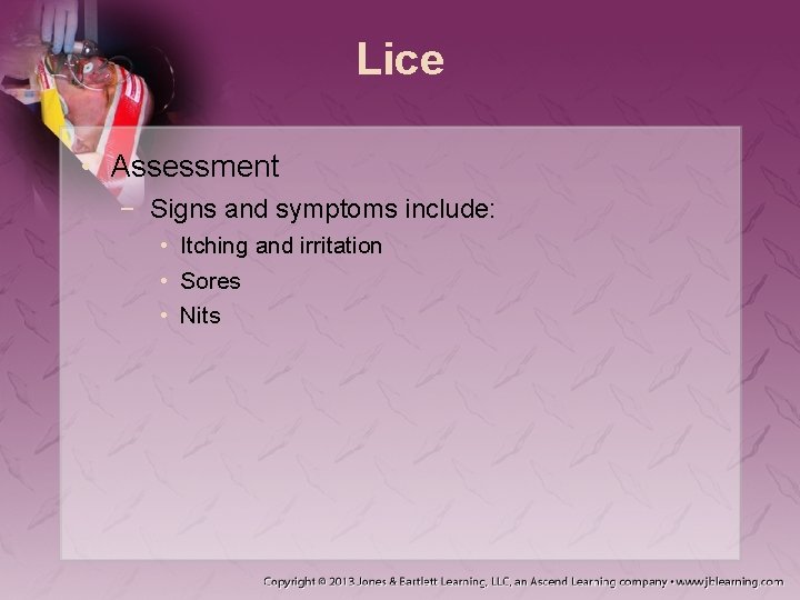 Lice • Assessment − Signs and symptoms include: • Itching and irritation • Sores