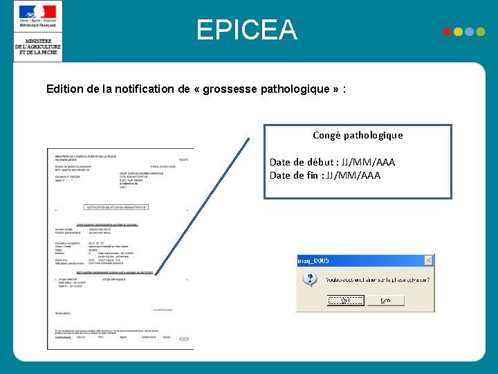 EPICEA Edition de la notification de « grossesse pathologique » : Congé pathologique Date