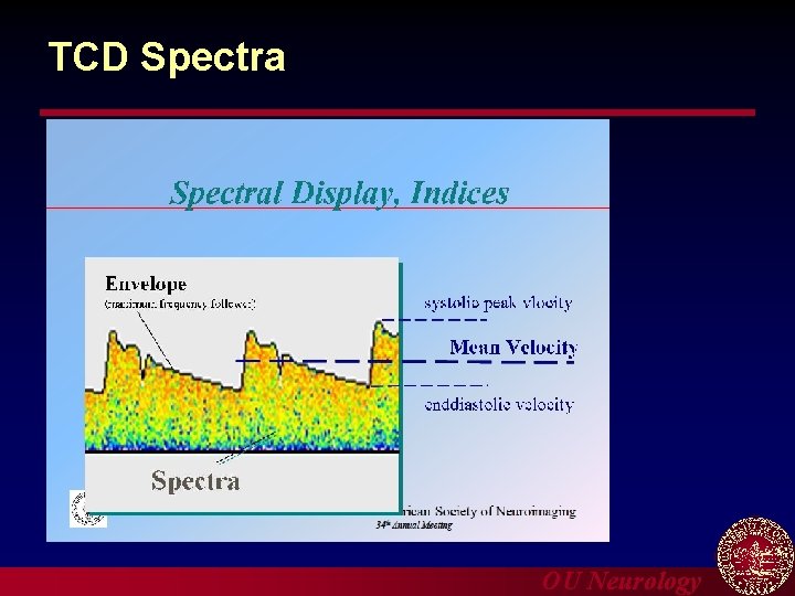 TCD Spectra OU Neurology 