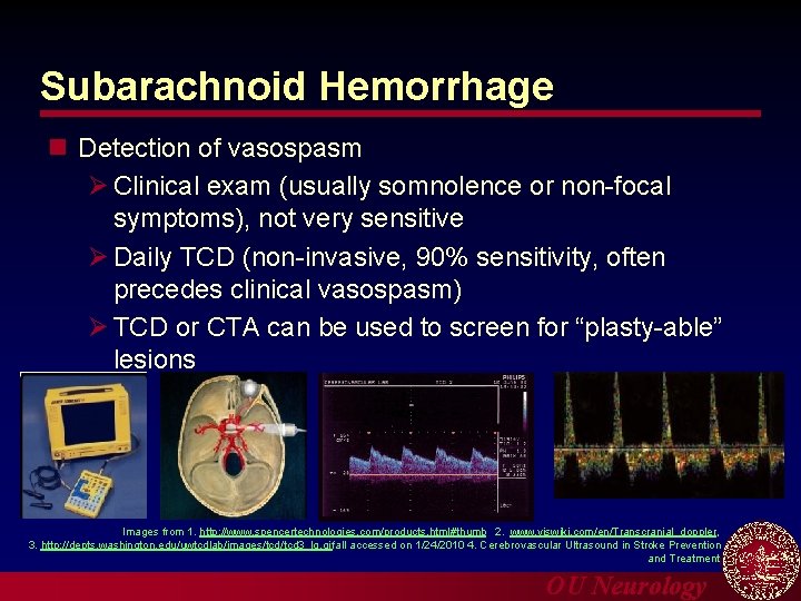 Subarachnoid Hemorrhage n Detection of vasospasm Ø Clinical exam (usually somnolence or non-focal symptoms),