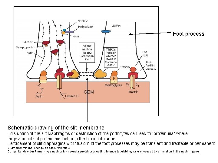 Foot process Schematic drawing of the slit membrane - disruption of the slit diaphragms