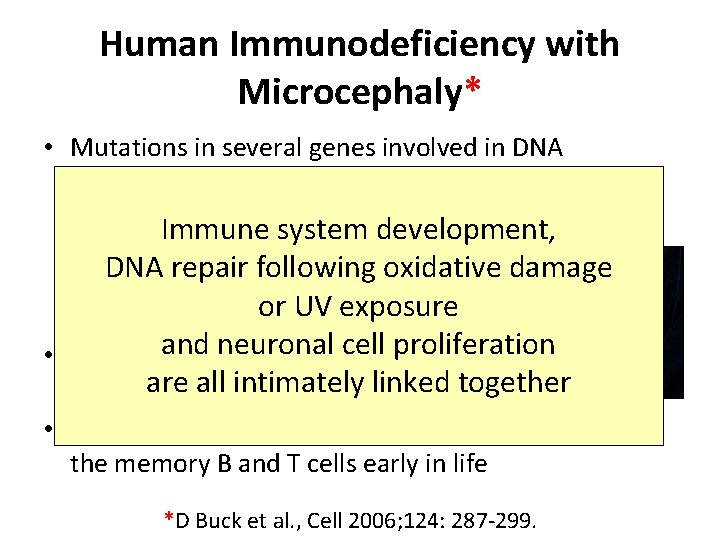 Human Immunodeficiency with Microcephaly* • Mutations in several genes involved in DNA repair mechanisms