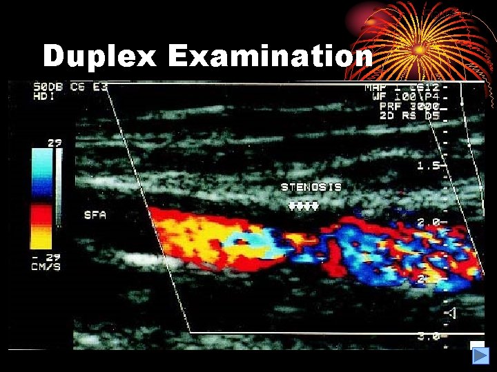Figure 1. 4 Duplex Examination 