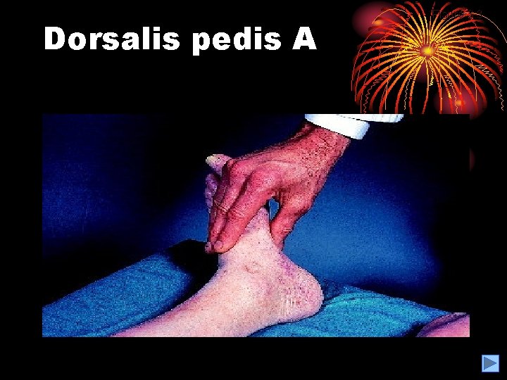 Dorsalis pedis A Figure 3. 3 