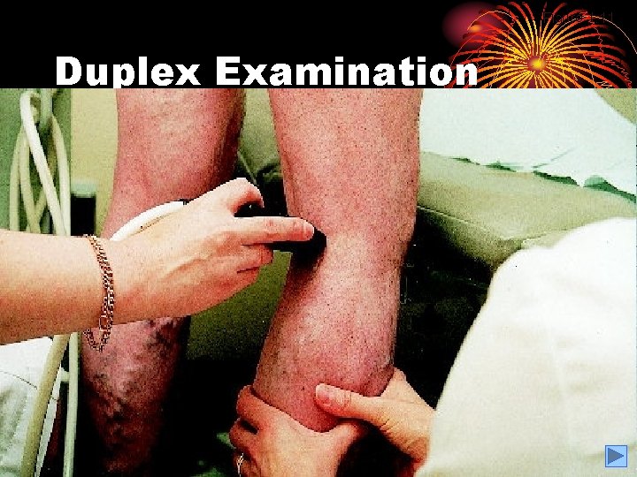 Figure 1. 11 Duplex Examination A B 