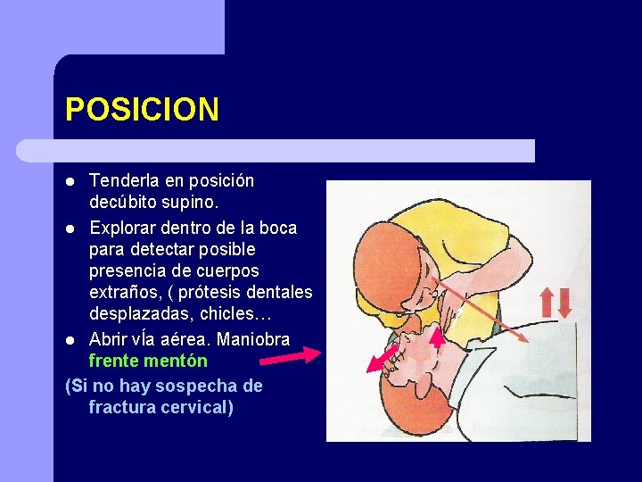 POSICION Tenderla en posición decúbito supino. l Explorar dentro de la boca para detectar