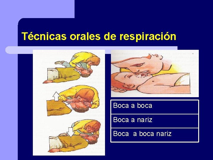 Técnicas orales de respiración Boca a boca Boca a nariz Boca a boca nariz