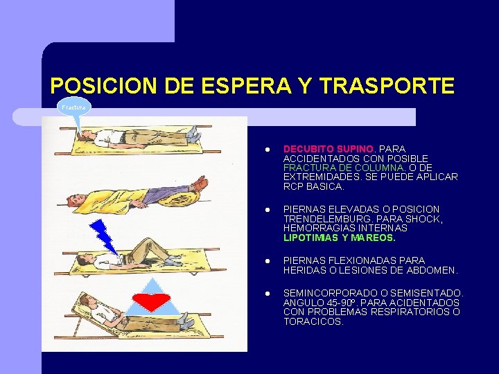 POSICION DE ESPERA Y TRASPORTE Fractura l DECUBITO SUPINO. PARA ACCIDENTADOS CON POSIBLE FRACTURA