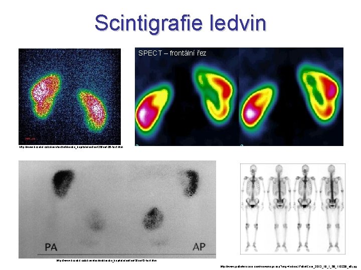 Scintigrafie ledvin SPECT – frontální řez http: //www. kcsolid. cz/zdravotnictvi/klinicka_kapitola/nef-26/nef-26 -text. htm http: //www.