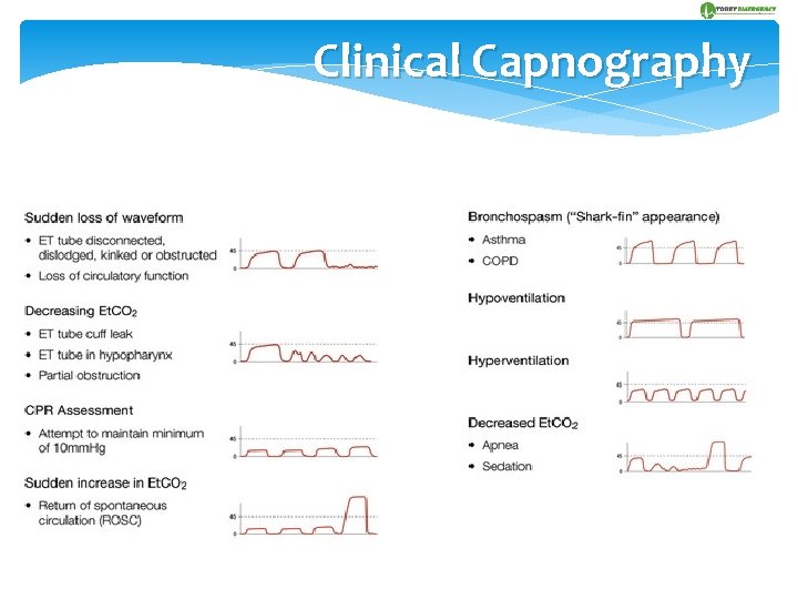 Clinical Capnography 