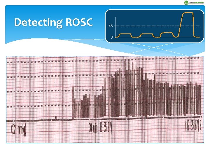 Detecting ROSC 45 0 Continuous ETCO 2 an almost immediate indicator of successful resuscitation