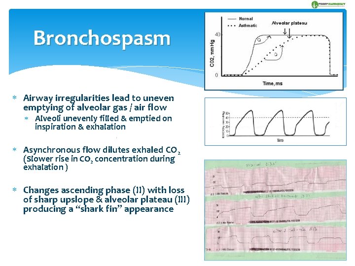 Bronchospasm Airway irregularities lead to uneven emptying of alveolar gas / air flow Alveoli