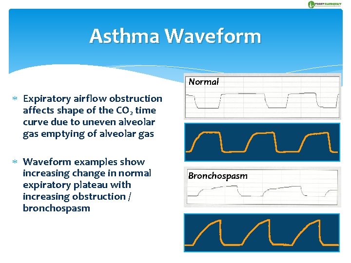 Asthma Waveform Normal Expiratory airflow obstruction affects shape of the CO 2 time curve