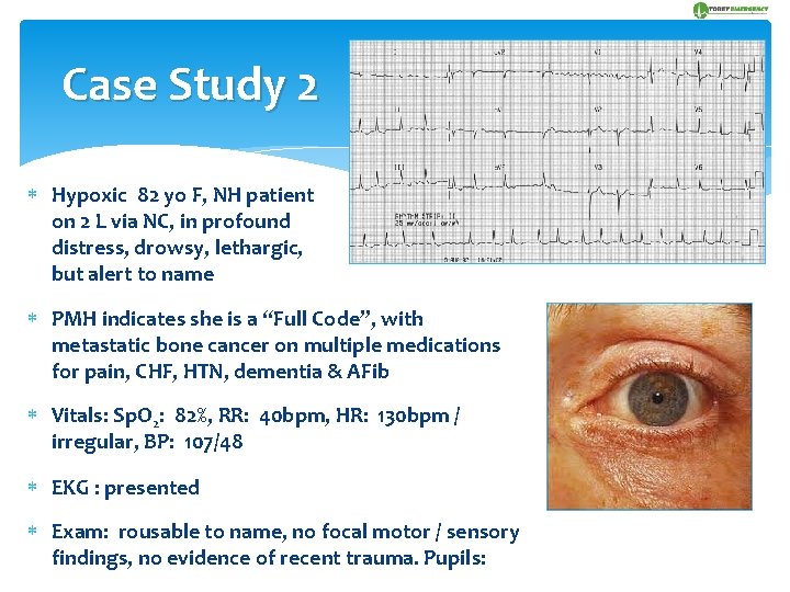 Case Study 2 Hypoxic 82 yo F, NH patient on 2 L via NC,