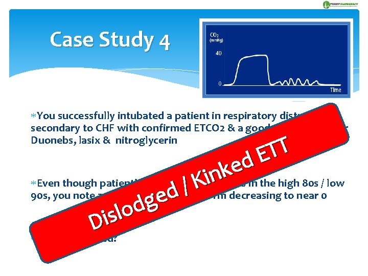 Case Study 4 You successfully intubated a patient in respiratory distress secondary to CHF