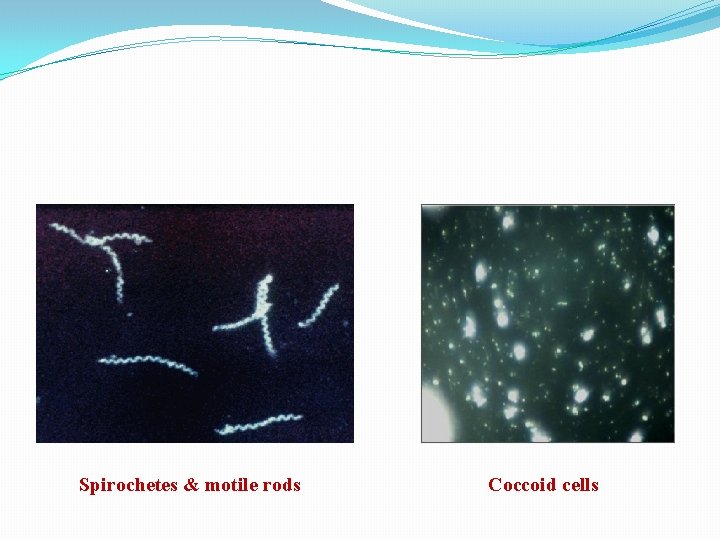 Spirochetes & motile rods Coccoid cells 