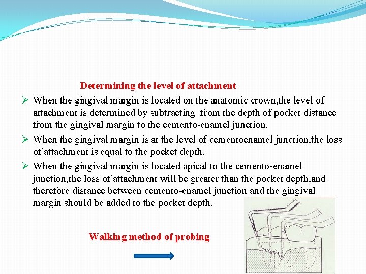 Determining the level of attachment Ø When the gingival margin is located on the