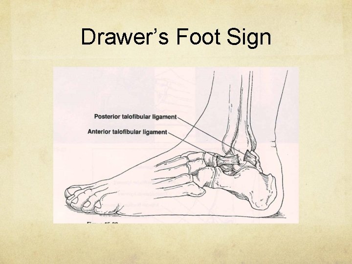 Drawer’s Foot Sign 