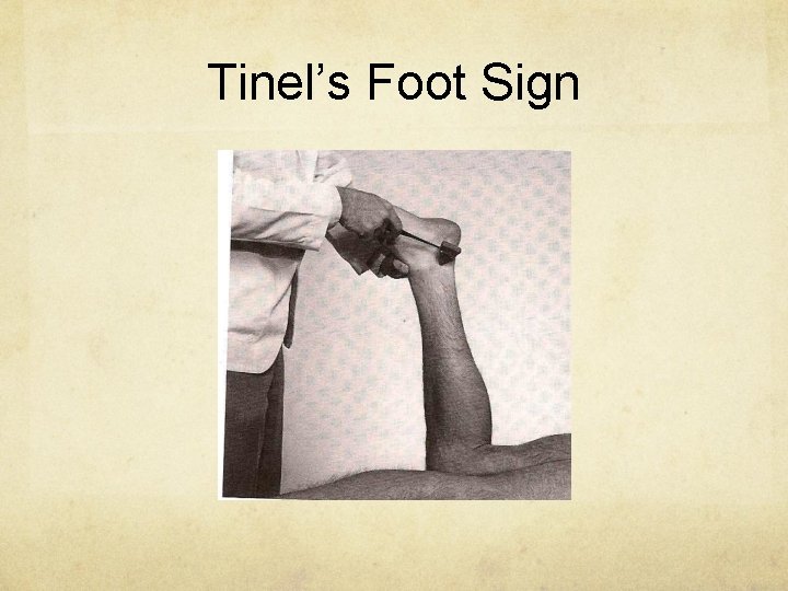 Tinel’s Foot Sign 