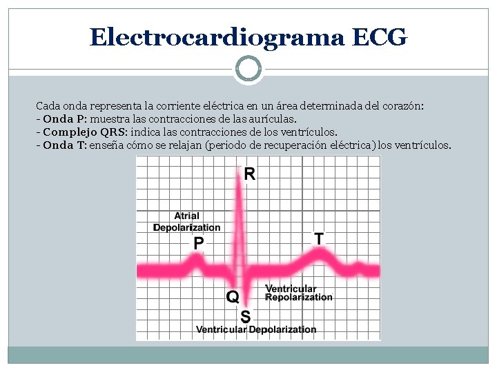 Electrocardiograma ECG Cada onda representa la corriente eléctrica en un área determinada del corazón: