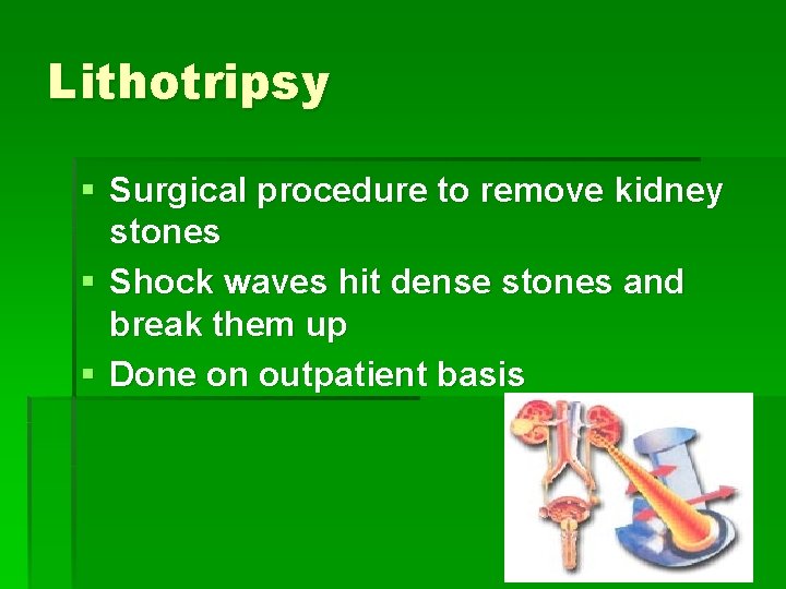 Lithotripsy § Surgical procedure to remove kidney stones § Shock waves hit dense stones