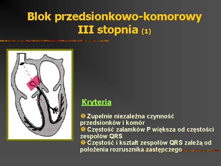 Blok przedsionkowo-komorowy III stopnia (1) Kryteria ] Zupełnie niezależna czynność przedsionków i komór ]