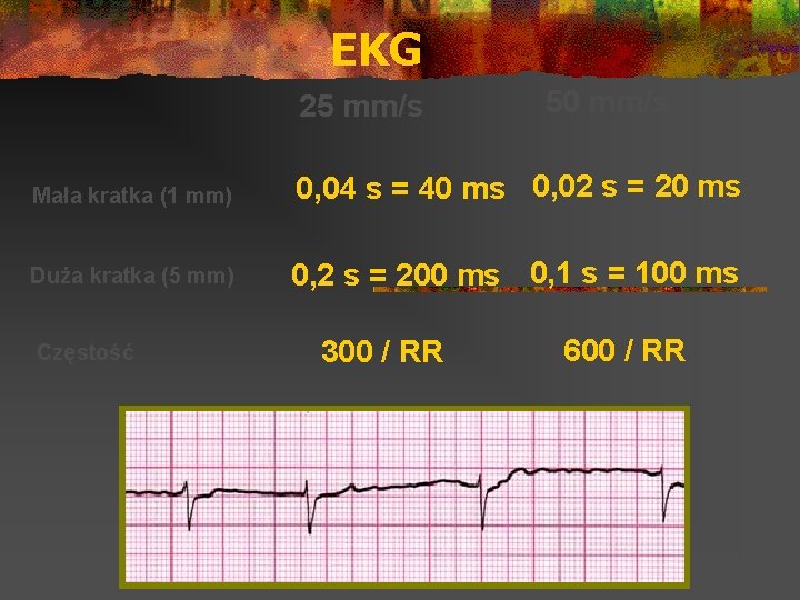 EKG 25 mm/s 50 mm/s Mała kratka (1 mm) 0, 04 s = 40