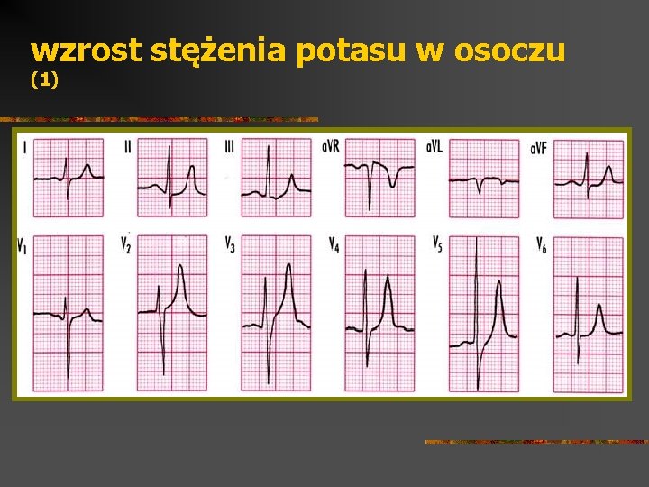 wzrost stężenia potasu w osoczu (1) 