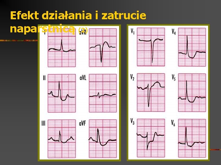 Efekt działania i zatrucie naparstnicą (2) 