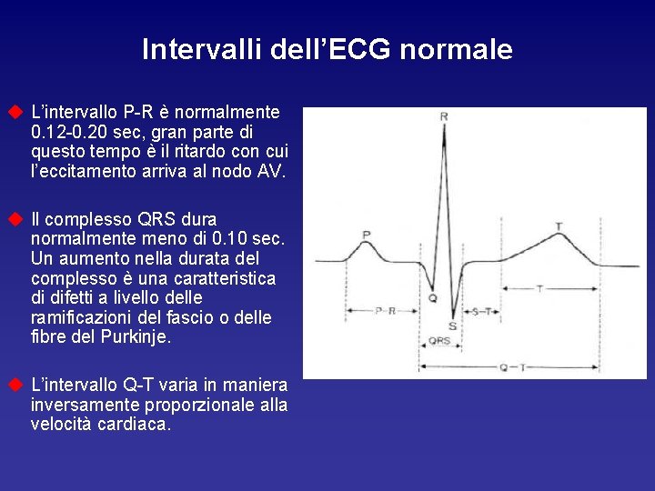 Intervalli dell’ECG normale u L’intervallo P-R è normalmente 0. 12 -0. 20 sec, gran