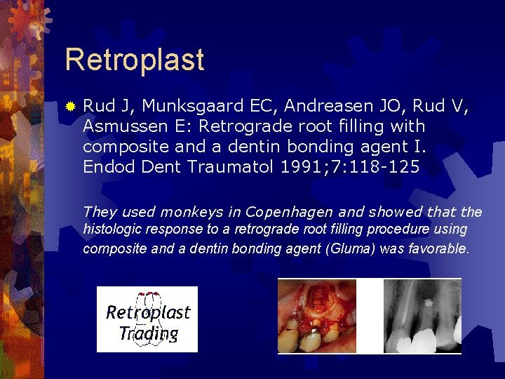 Retroplast ® Rud J, Munksgaard EC, Andreasen JO, Rud V, Asmussen E: Retrograde root