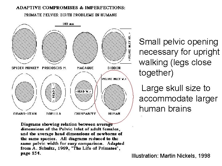Small pelvic opening necessary for upright walking (legs close together) Large skull size to