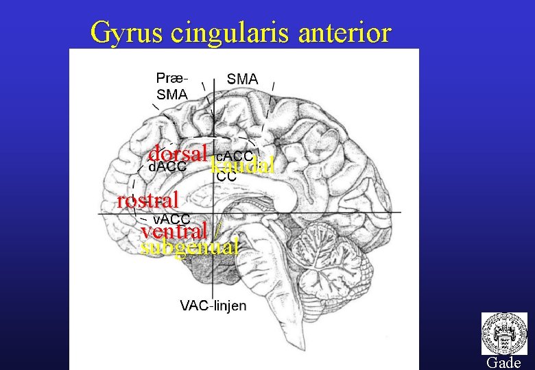 Gyrus cingularis anterior dorsal kaudal rostral ventral / subgenual 56 Gade 