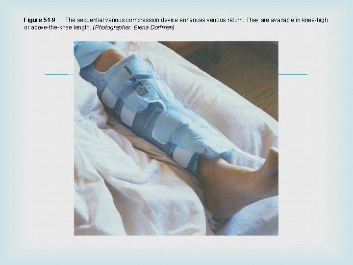 Figure 51 -9 The sequential venous compression device enhances venous return. They are available