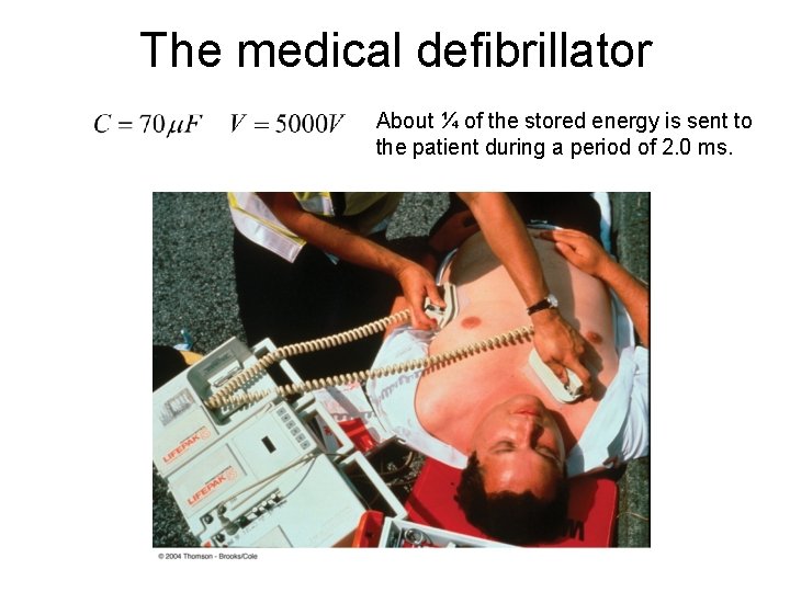 The medical defibrillator About ¼ of the stored energy is sent to the patient