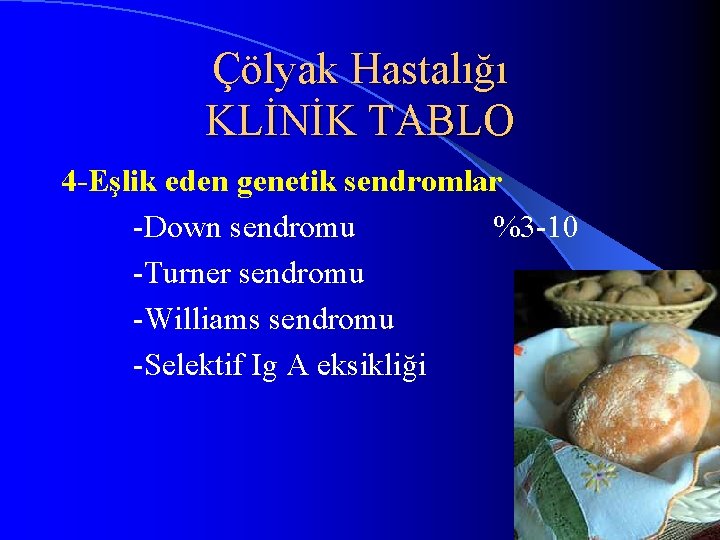Çölyak Hastalığı KLİNİK TABLO 4 Eşlik eden genetik sendromlar -Down sendromu %3 -10 -Turner