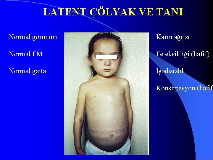 LATENT ÇÖLYAK VE TANI Normal görünüm Karın ağrısı Normal FM Fe eksikliği (hafif) Normal